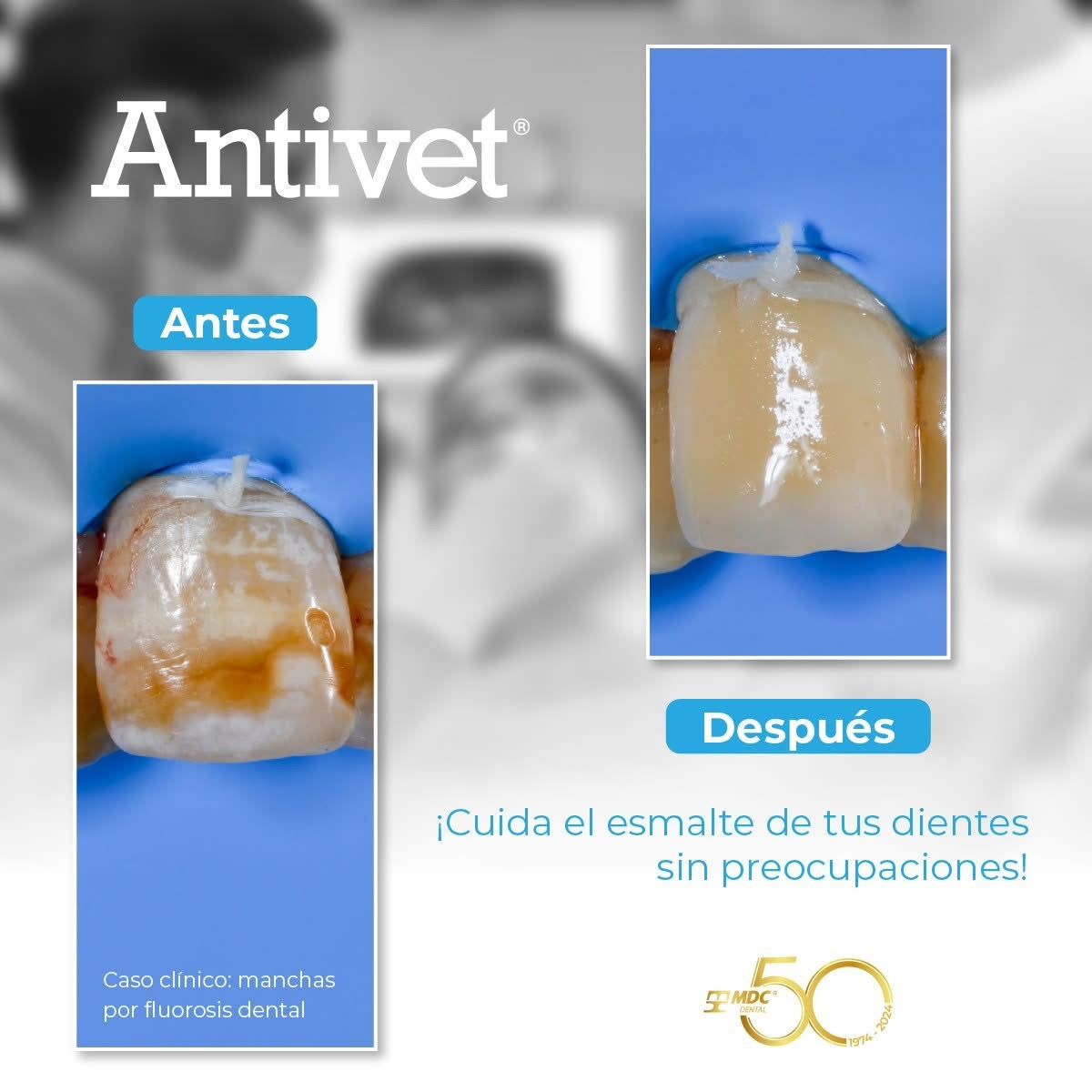 ANTIVET