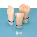 DIENTES REPUESTO